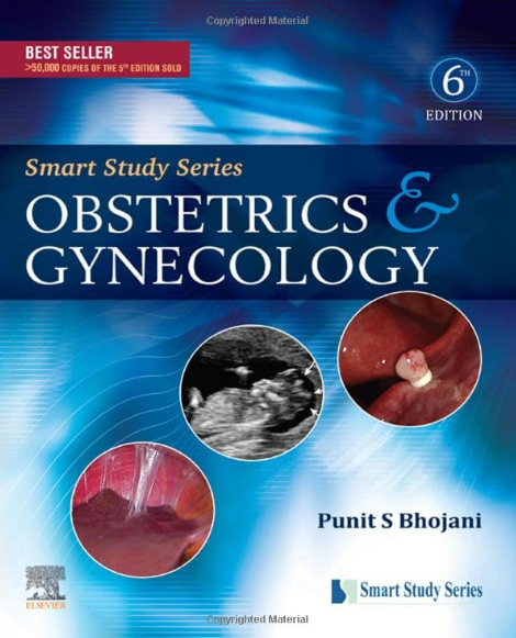 Smart Study Series: Obstetrics and Gynecology, 6e 